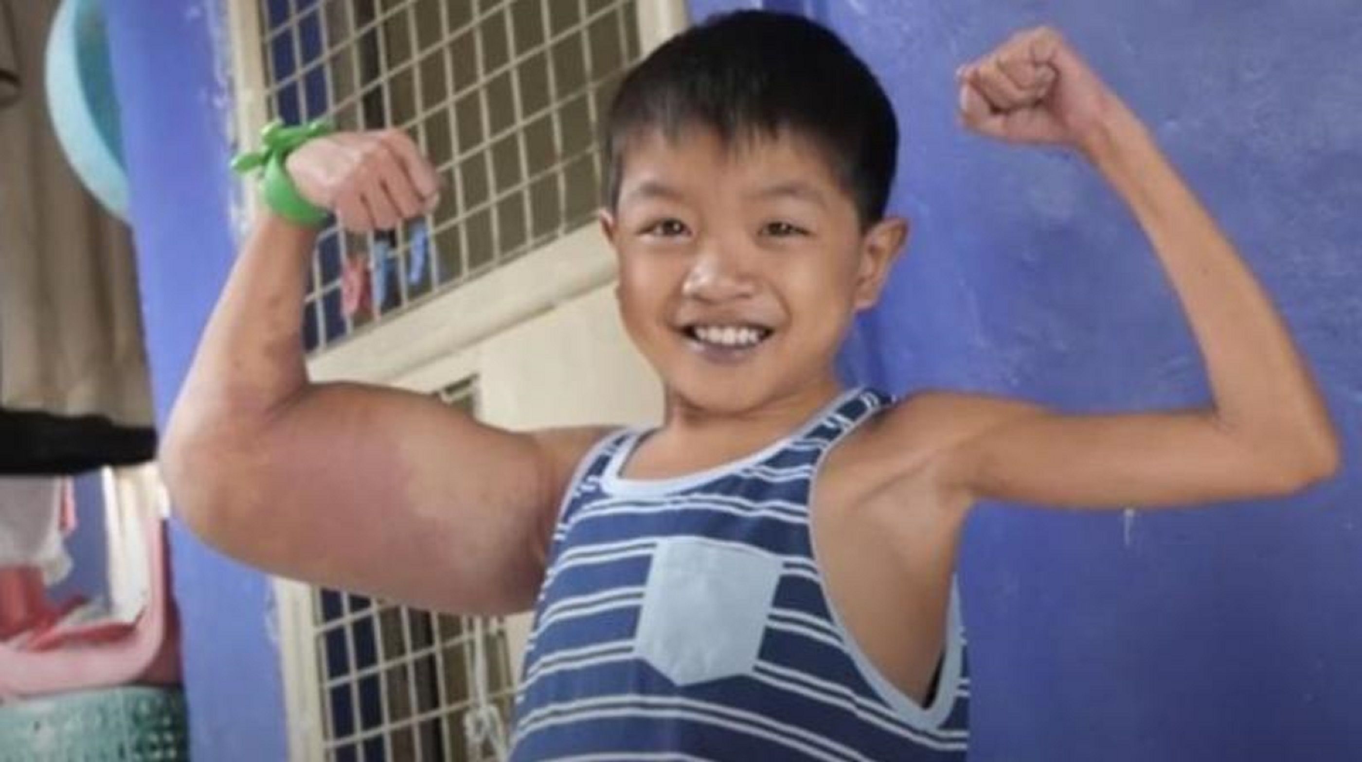 Karena Penyakit Misterius Bocah Ini Dijuluki Popeye Kenapa ya Semua Halaman Nova Grid ID
