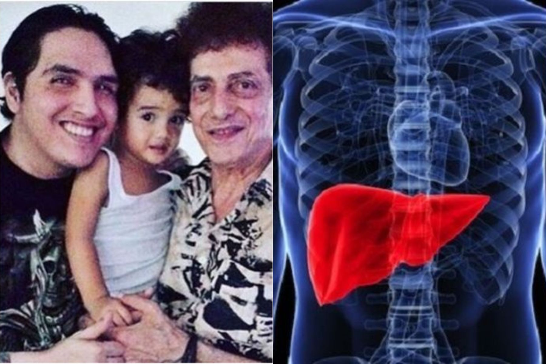 Faldy Albar Meninggal Akibat Penyakit Liver Ini 8 Cara Melindungi Liver Semua Halaman Nakita ID