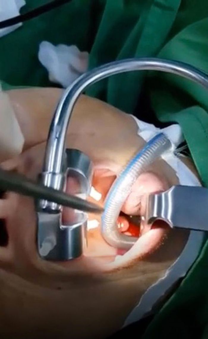 Minum Air Alami Pegunungan Wanita Ini Alami Migrain