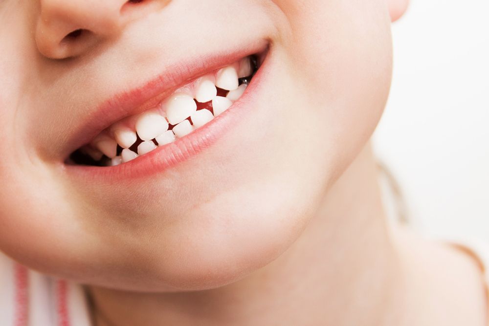 Inilah 3 Perbedaan Antara Gigi Susu dan Gigi Tetap, dan 2 Penyebab Utama  Gigi Menjadi Rusak - Semua Halaman - Grid Health