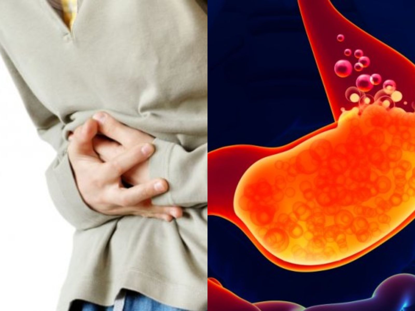 Ini Gejala Asam Lambung Naik Salah Satunya Bersendawa Terus