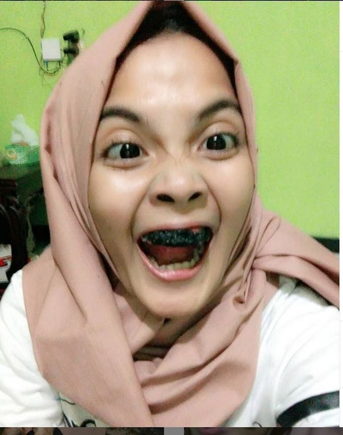 Gambar Orang Gigi Ompong Rahman Gambar