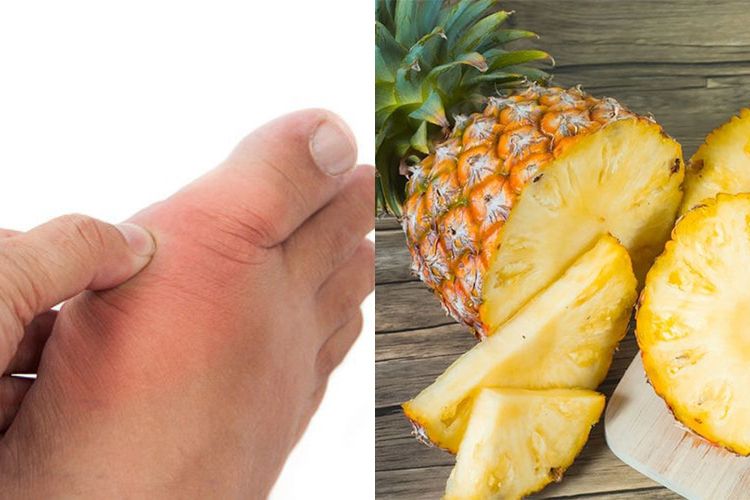 Simak Manfaat Jus Nanas Campur Madu 