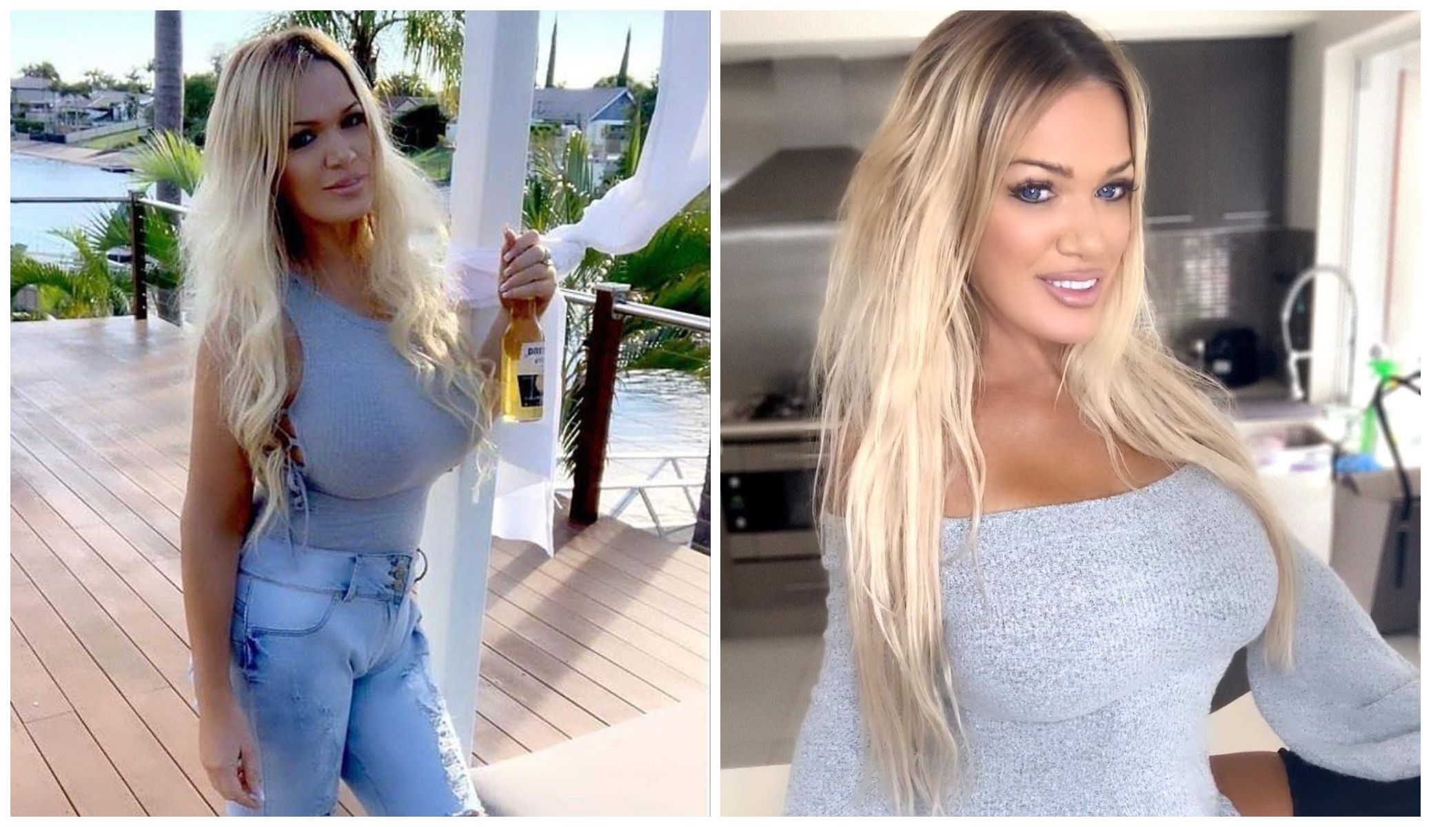 Gina Darling Implants
