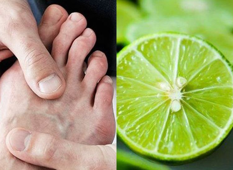 Sembuhkan Asam Urat Secara Total Dengan Jeruk Nipis