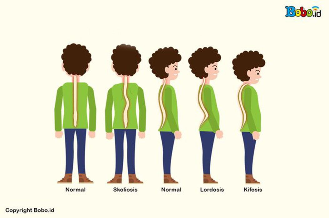 Contoh Gangguan Pada Sistem Gerak Manusia Dan Penyebabnya Semua Halaman Bobo