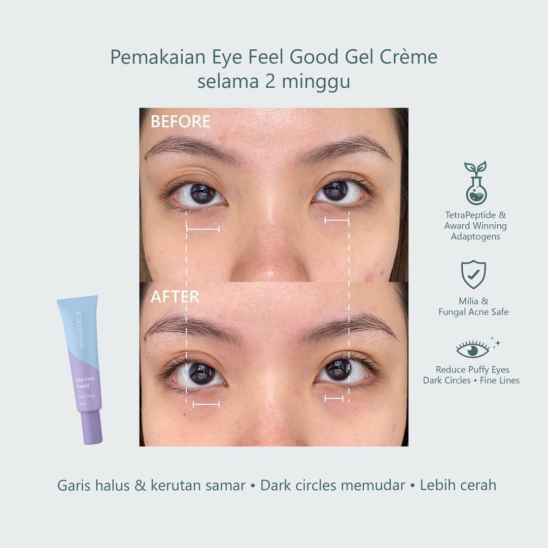 eye cream untuk milia