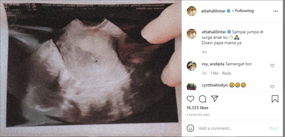 Kehamilan Aurel Hermansyah 5 Hari Bedrest Usia Kehamilan 5 Minggu Keguguran Semua Halaman Grid Health