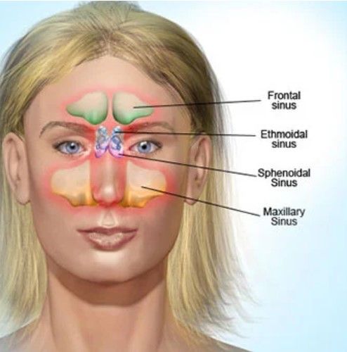 18 Gejala Dini Penyakit Infeksi Hidung yang Mengarah ke Sinusitis - Semua  Halaman - Grid Health