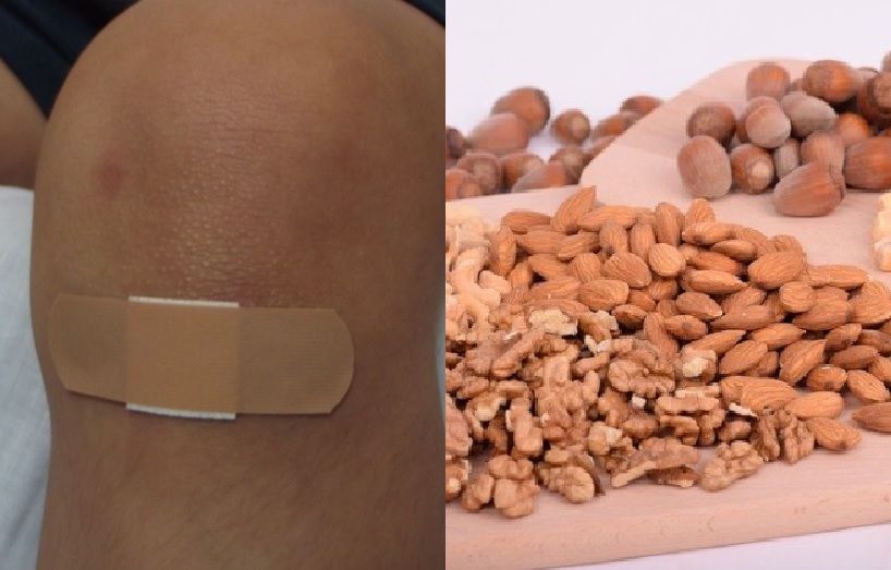 6 Makanan Untuk Obat Luka Agar Cepat Kering Murah Meriah Dan Mudah Didapat Semua Halaman Sajian Sedap