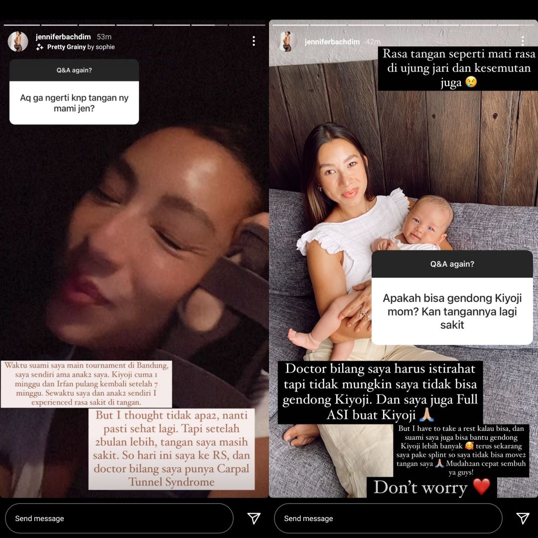 Ditinggal Irfan Bachdim Selama 7 Minggu Jennifer Bachdim Alami Carpal Tunnel Syndrome Karena Terlalu Sibuk Mengurus Anak Dan Rumah<script async src=