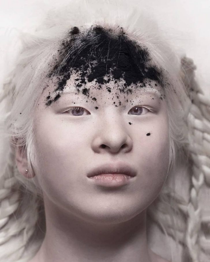Xueli Gadis Albino Yang Sempat Dibuang Dan Kini Jadi Model Vogue