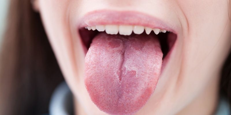 Cara menghilangkan mulut pahit