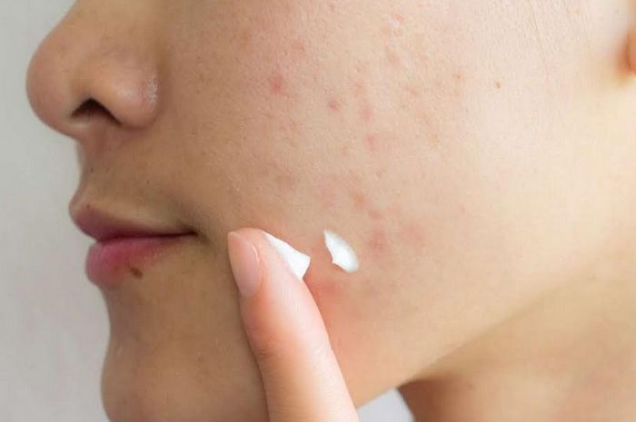 5 Tips Menjaga Kesehatan Kulit agar Tetap Terawat