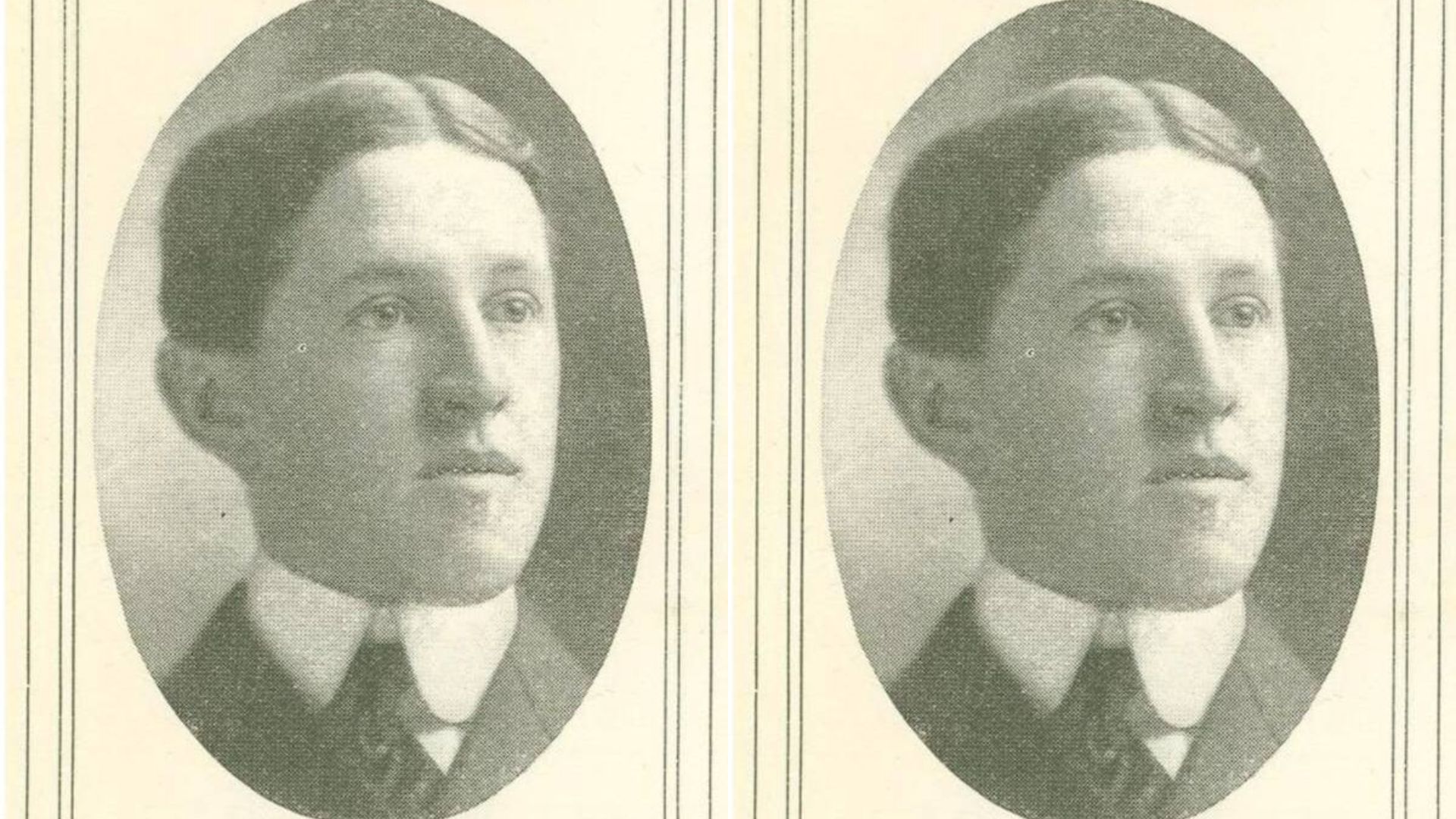 Rahangnya Hancur Berkepingkeping, Begini Foto Rahang Eben Byers