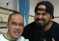 Penyakit yang Diderita Agung Hercules Makin Parah, Tumor Baru Kembali Tumbuh