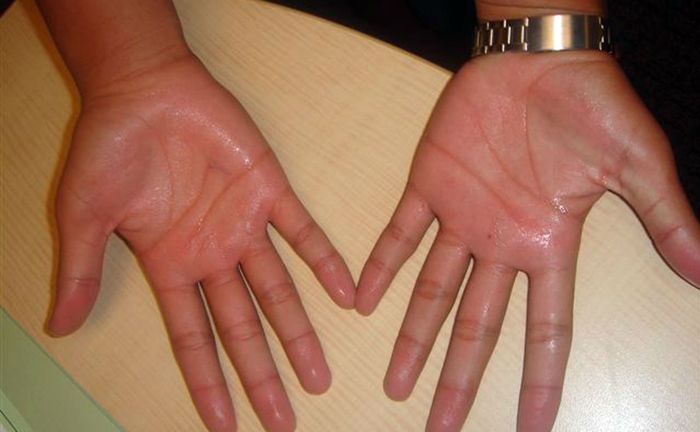 6 Hal Ini Diyakini Bisa Tunjukkan Bahwa Wanita Sudah Tidak Perawan Lagi Salah Satunya Dari Telapak Tangan Semua Halaman Intisari 6 Hal Ini Diyakini Bisa Tunjukkan Bahwa Wanita Sudah Tidak Perawan Lagi Salah Satunya Dari Telapak Tangan Semua Halaman Intisari