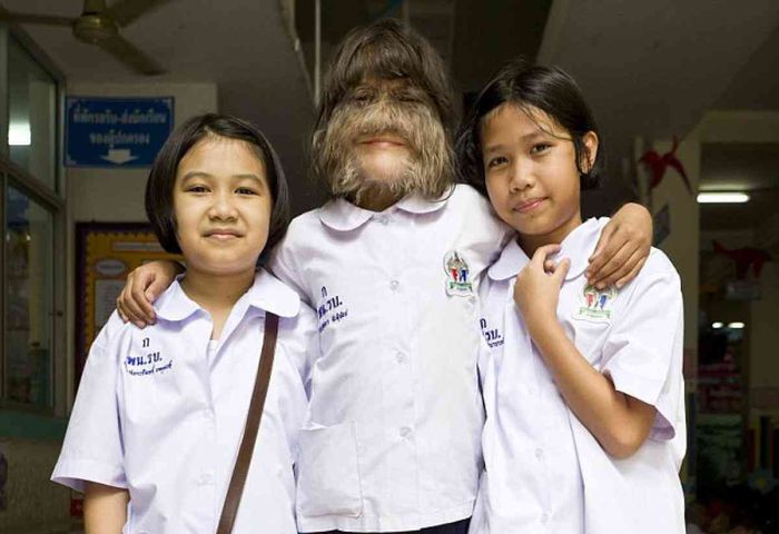 Wajahnya Dipenuhi Bulu Lebat Bak Manusia Serigala, Begini Rupa Asli