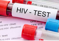 Tidak Hanya Obat Oral, Perawatan Alternatif Ini Bisa Membantu Penderita HIV, Salah Satunya Meditasi