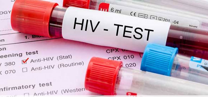 Lakukan tes HIV bila mengalami gejala-gejala tertular penyakit tersebut.