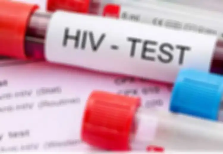 Kenali Gejala HIV pada Kulit, Termasuk Salah Satunya Mulut yang Seperti Berbulu
