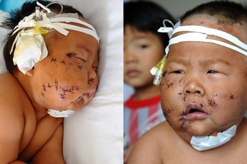 Hasil gambar untuk Kasian, Bayi 8 Bulan Ditusuk 90 Kali dengan Gunting Gara-gara Gigit Puting Ibunya Saat Menyusui