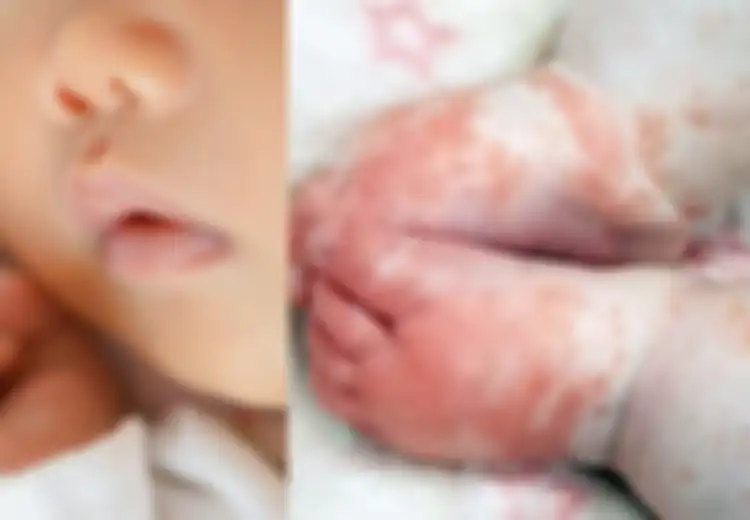 Jadi Korban Pertama yang Meninggal Karena Kondisi Covid-19 Langka, Kisah Bayi Usia 8 Bulan Ini Berhasil Selamatkan Puluhan Anak Lainnya