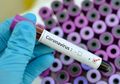 Kemenkominfo Klarifikasi Obat Chloroquine Dapat Sembuhkan Corona