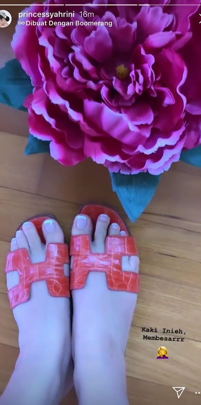 Unggahan instastory Syahrini pamer kaki bengkak