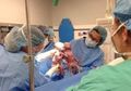 Heboh di Ruang Persalinan! Dokter Teriak Usai Bantu Kelahiran Bayi Kembar, Sampai-sampai Sang Ibu Penasaran dan Kaget Lihat Kondisi Bayinya, Apa yang Terjadi?