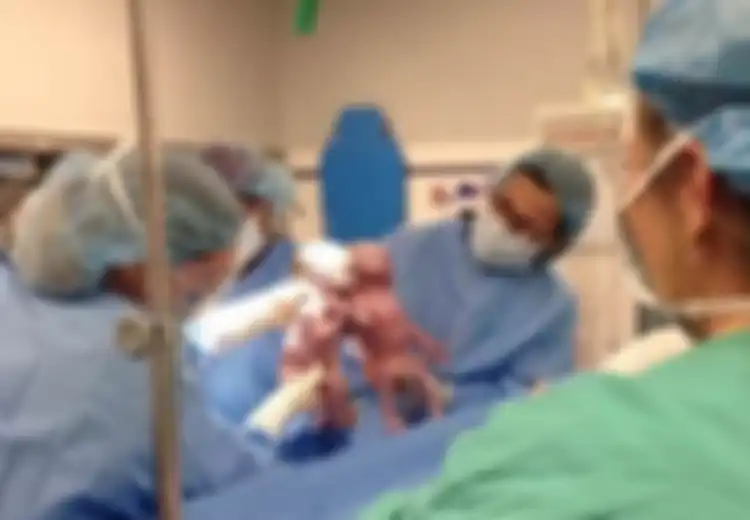 Bayi Kembar Ini Kejutkan Satu Ruangan dan Bikin Dokter Menjerit Usai Lahir, Sang Ibu yang Penasaran pun Kaget Melihat Bayinya seperti Ini!