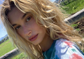 Miliki Jari Kelingking Tak Normal, Hailey Bieber Ungkap Miliki Kelainan Genetik Ectrodactyly