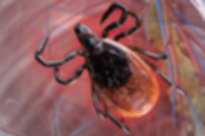 Setidaknya sembilan orang lainnya telah meninggal karena infeksi jantung yang sulit dideteksi. Seperti apa penyakit Lyme carditis ini?