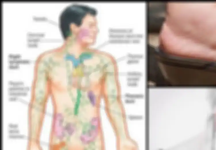 Sistem Getah Bening Juga Perlu Detoksifikasi, Berikut 5 Cara Alami yang Dapat Anda Lakukan!