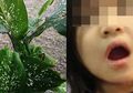 Waspada Daun Sri Rejeki Ternyata Beracun, Anak Usia 4 Tahun Kejang dan Mati Rasa Setelah Menggigitnya