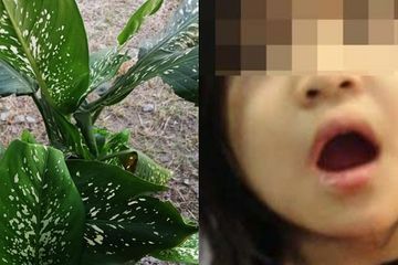 Nashwa setelah menggigit daun Sri Rejeki mengalami kejang dan mati rasa.