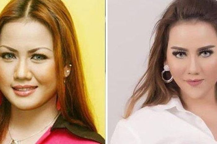 Blak-blakan Akui Lakukan Operasi Plastik, Nita Thalia ...