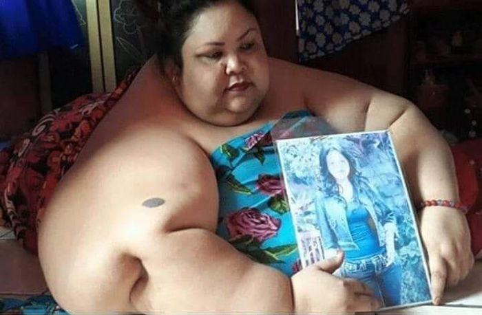 Titi Wati wanita berberat badan 350 Kg tunjukan fotonya yang dulu