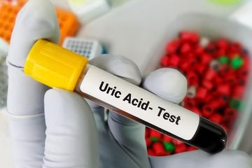 Inilah angka normal asam urat pada laki-laki dan wanita