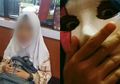 Demi Bongkar Isi Otak Gadis ABG Pembunuh Bocah 5 Tahun, Polisi Isolasi dan Undang 10 Dokter Spesialis Khusus, Lantas Bagaimana Hasilnya?