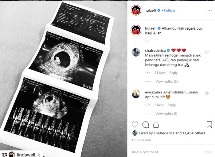 Unggahan Achmad Hulaefi perihal kehamilan istrinya (Instagram/hulaefi)
