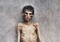 Lolos dari Maut yang Merenggut 13.000 Jiwa dalam Kondisi Sangat Kelaparan, Inilah Wajah Mengerikan para Penyintas Perang Sipil di Amerika, Kamp untuk Tampung 10.000 Orang Diisi Empat Kali Lipatnya