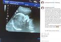 Berita Kesehatan Terkini dan Kehamilan Popular: Kehamilan 4 Bulan Artis Kartika Putri Terkena Infeksi Varicella, Kucing Ternyata Bisa Cegah Penyakit Mematikan
