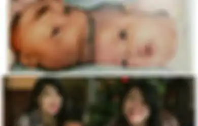 Organ Hati Kembar Siam Ardi dan Ardan Berhasil Dipisahkan: Ini 5 Kisah Kembar Siam Paling Dikenang di Dunia, Ada dari Indonesia Juga