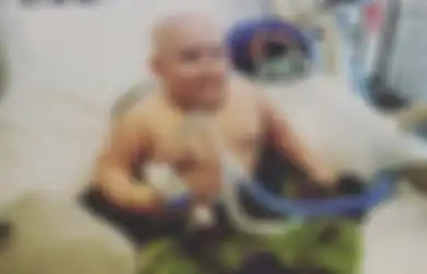 Mengenal Sindrom ROHHAD, Penyakit yang Diderita Bocah 4 Tahun yang 'Dibully' Orang Dewasa Karena Berat Badannya