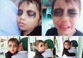 Viral Ibu yang Menghitamkan Mata Anaknya Hingga Si Anak Menangis, Ternyata Ada Alasan Menarik di Baliknya