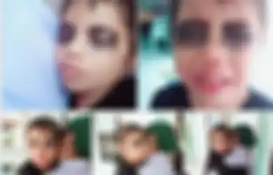 Viral Ibu yang Menghitamkan Mata Anaknya Hingga Si Anak Menangis, Ternyata Ada Alasan Menarik di Baliknya
