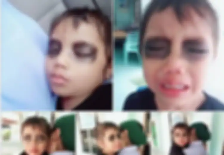 Viral Ibu yang Menghitamkan Mata Anaknya Hingga Si Anak Menangis, Ternyata Ada Alasan Menarik di Baliknya