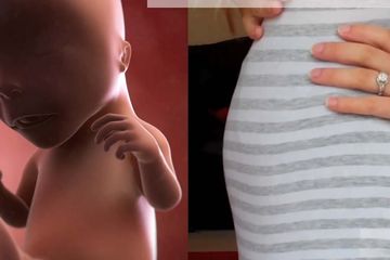 Infeksi virus corona bisa menular melalui plasenta ke bayi yang dikandung ibu yang positif Covid-19