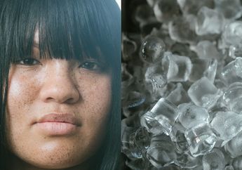 Semua Wanita Pasti Lagi Nangis di Pojokan Saking Nyesal karena Baru Tahu, Flek Hitam di Wajah Bisa Hilang dengan Cepat Pakai Es Batu Saja, Begini Caranya
